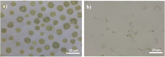 写真：マレーシアで単離した微細藻類 a)コエラストルムとb)モノラフィジウム