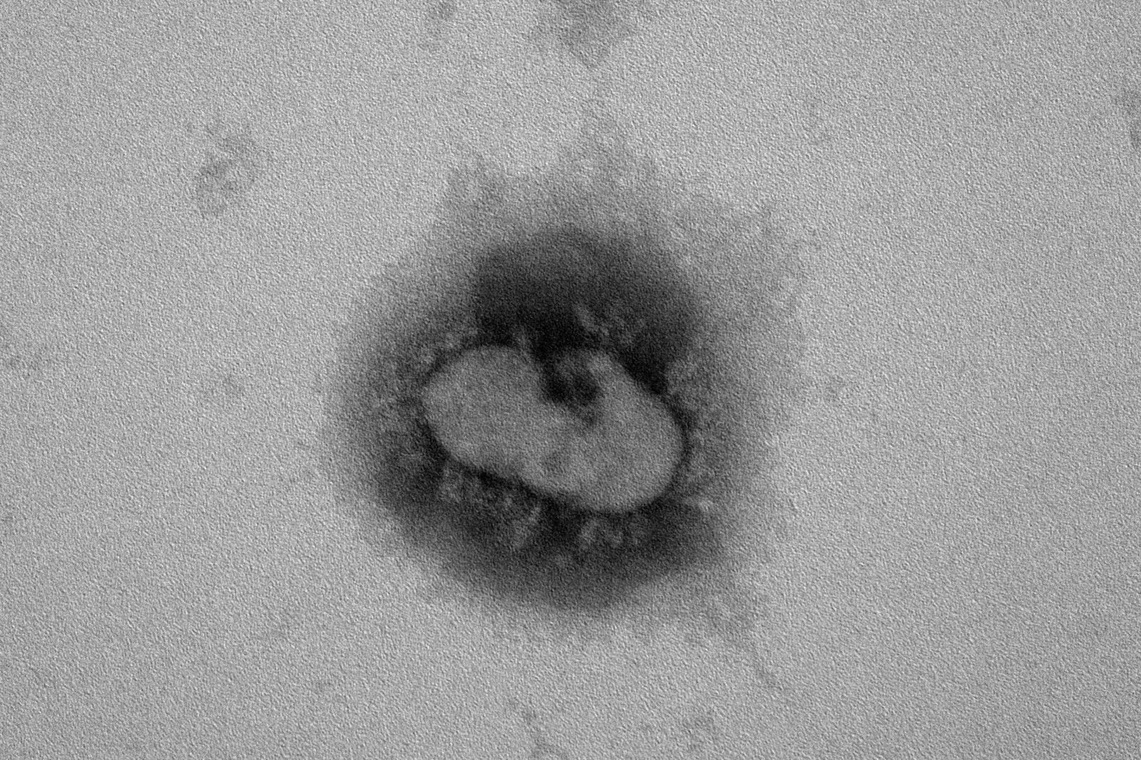 新型コロナウイルスをバラバラに 世界初 ナノイー（帯電微粒子水）技術による不活化メカニズムの一部を解明