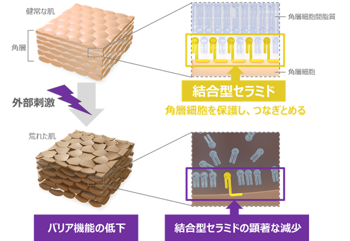 セラミド研究会学術集会で北海道大学と共同発表「乾燥肌と関わりの深い「結合型セラミド」の新たな可能性を発見」