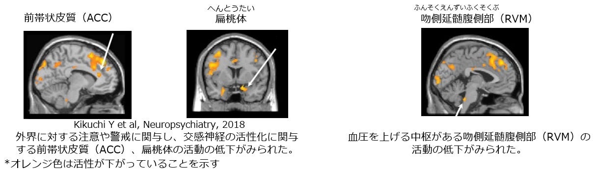 ＜令和・平成・昭和 生まれのアレルギーの子をもつ親の『対策』調査＞時を経ても変わらぬ意識。実は、アレルギー疾患の子をもつ親の99％が、発症後に対策を開始。適切なタイミングで“予防”ができていなかった！