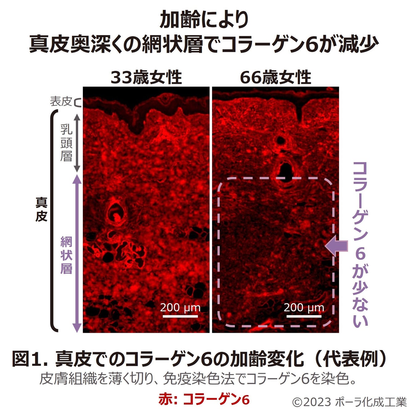 「肌内部のハリ弾力」を実感しやすい肌表面へ