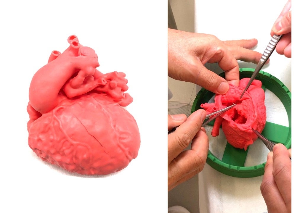 先天性心疾患の手術支援が可能な「軟質実物大3D心臓モデル」医療機器承認（クラスⅡ） を取得