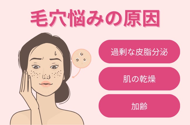 【女性に調査】最も多くの方が悩む毛穴悩みは「黒ずみ毛穴」！春から気を付けるべきポイントとは