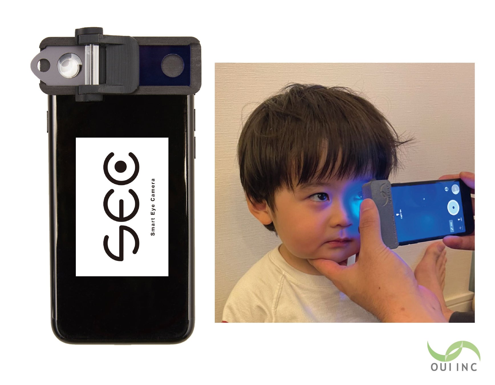 Smart Eye CameraがWHO compendium of innovative health technologies for low-resource settings 2024に掲載