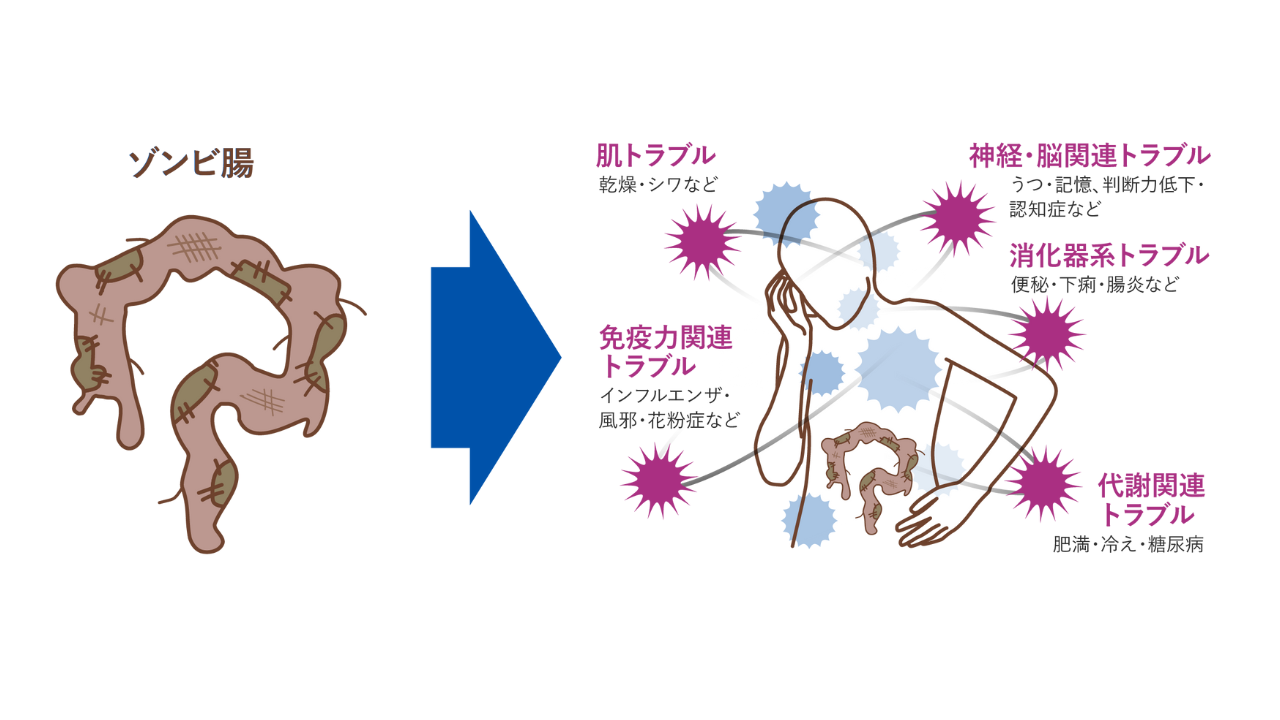 日本初の便秘外来を開設した小林弘幸教授が提唱する
新キーワード「ゾンビ腸」　
現代日本人の約6割が「ゾンビ腸」化　
そのカラダの不調は、すべて“不腸”のせいだった！？
「ゾンビ腸」書籍化を記念し、対策メニューも登場