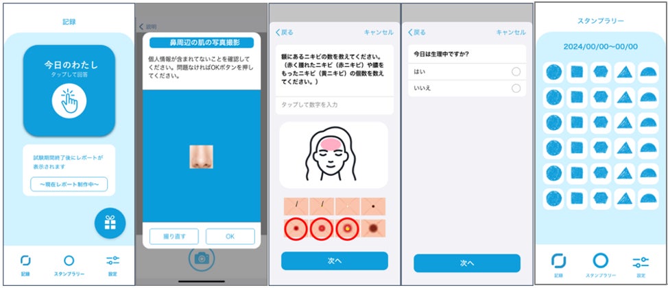 大人ニキビの発症に関わる生活習慣を明らかにするため、スマートフォンアプリを活用した調査を開始