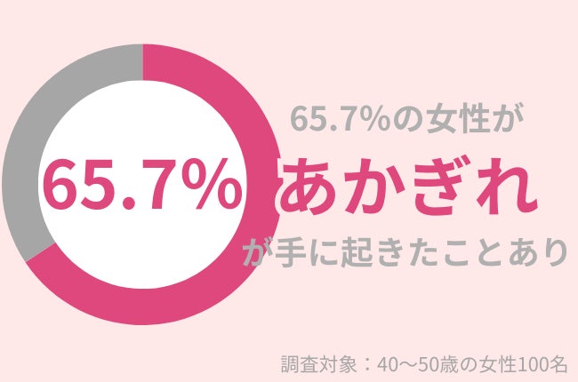 65.7％の40代女性が手に「あかぎれ」が起きたことがある：効果的なケアで予防・改善を目指す！