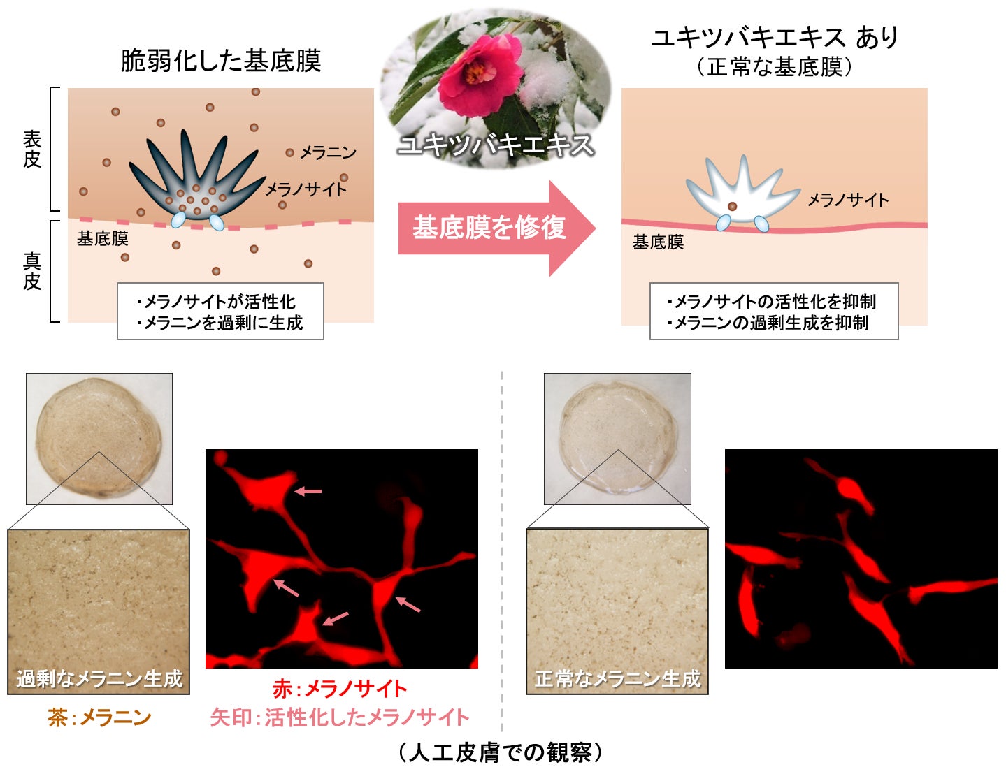 ユキツバキエキスにシミ部位におけるメラノサイトの過剰なメラニン生成を抑える効果を発見