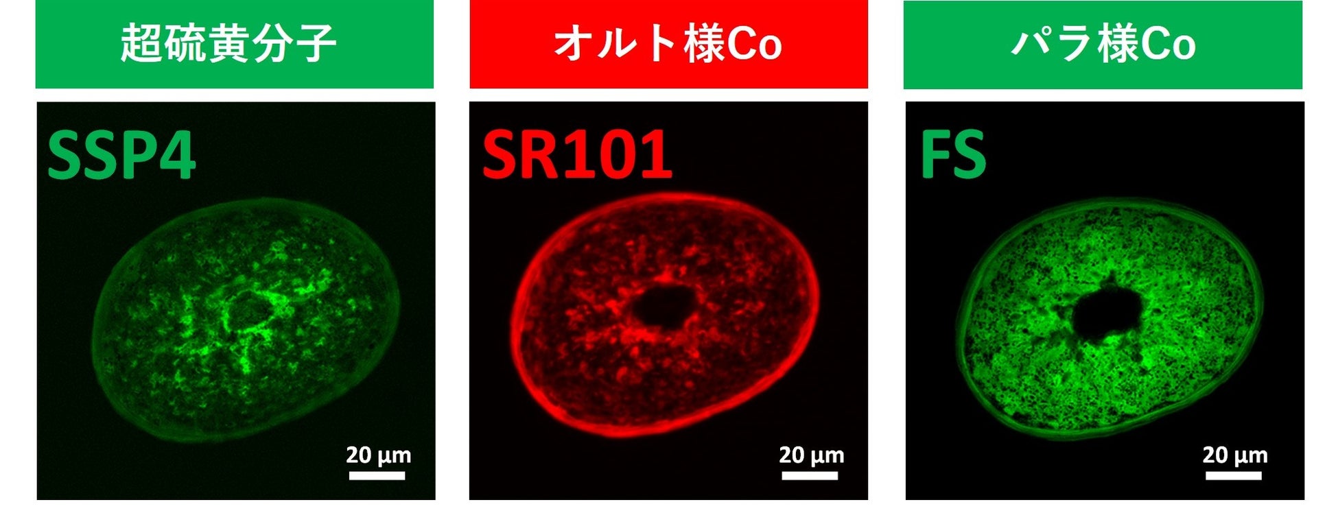 新たな結合『超硫黄分子』、コルテックスとメデュラでの存在を確認