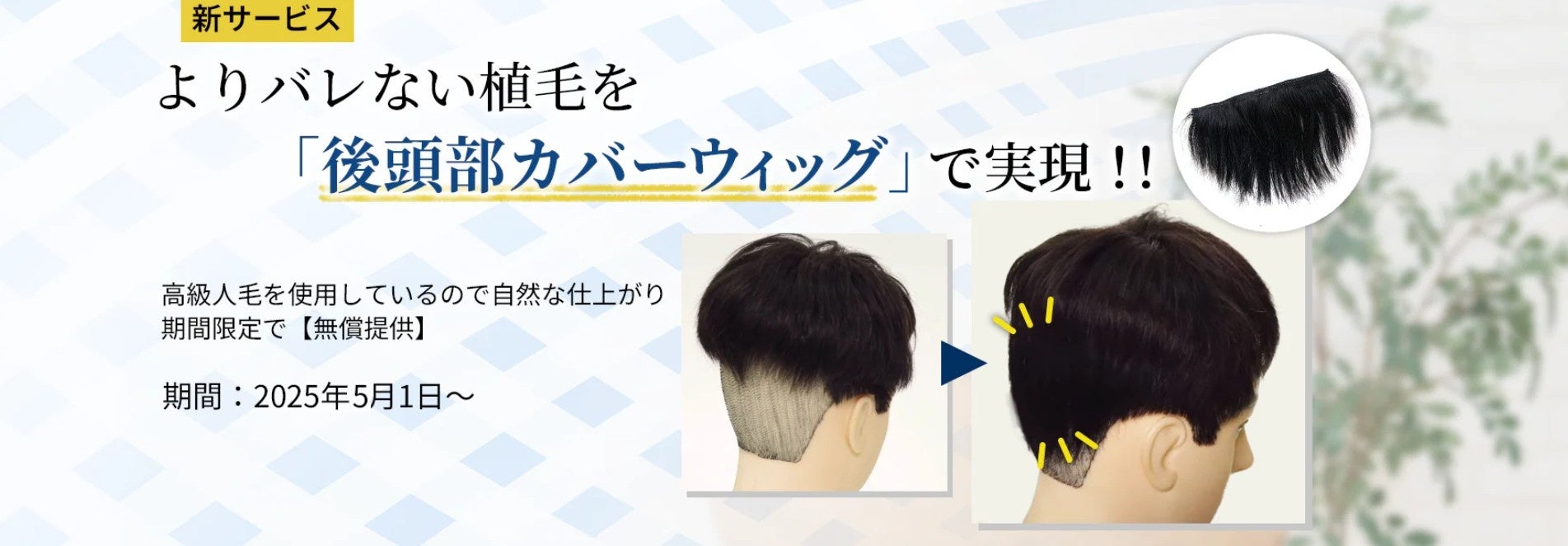 「植毛バレ」を防ぐ新提案！専用カバーウィッグ、無償提供スタート