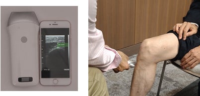 新製品「KINDO」登場！筋肉厚さ観察に特化したポータブルエコーで、スポーツ科学やヘルスケア分野に新たな可能性を提供