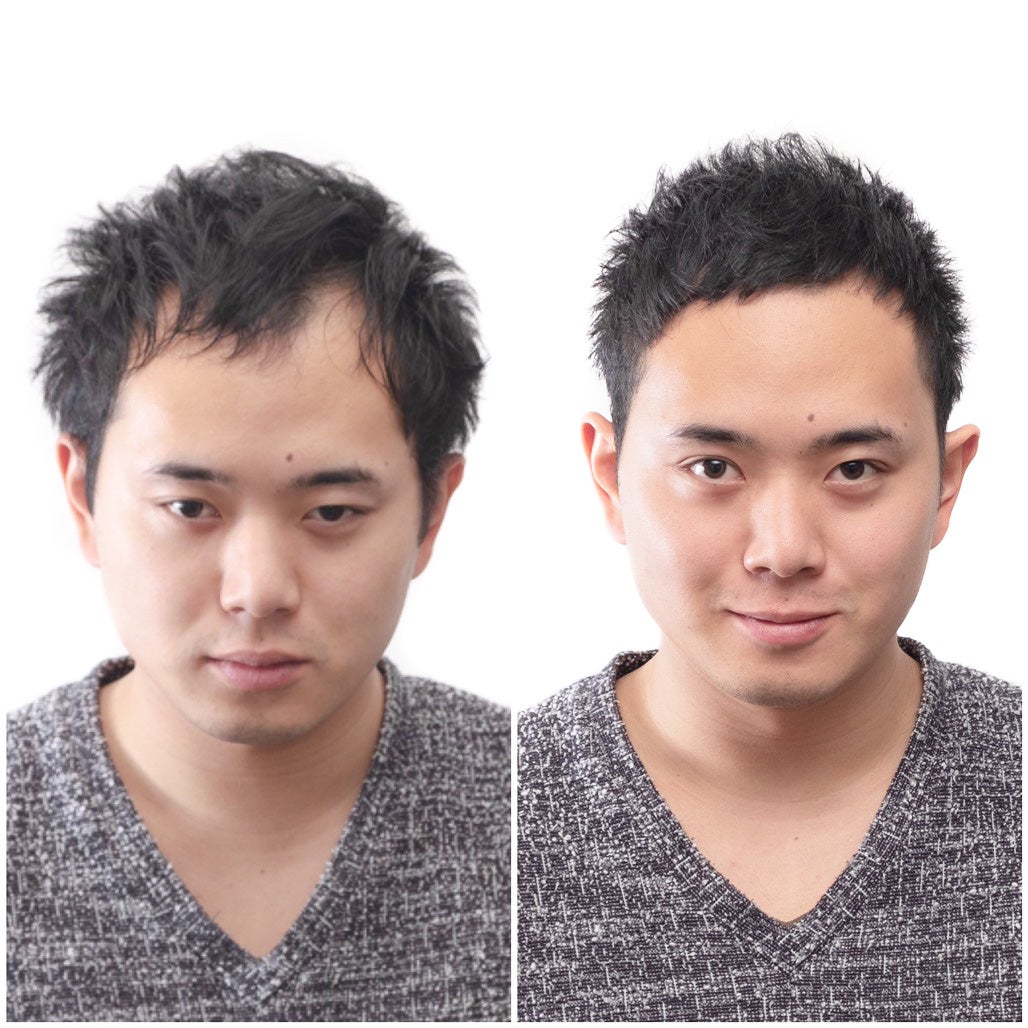 日本初の薄毛男性専門美容院「INTI（インティ）」が東海エリアに初進出！名古屋・池下に2025年7月2日オープン！
