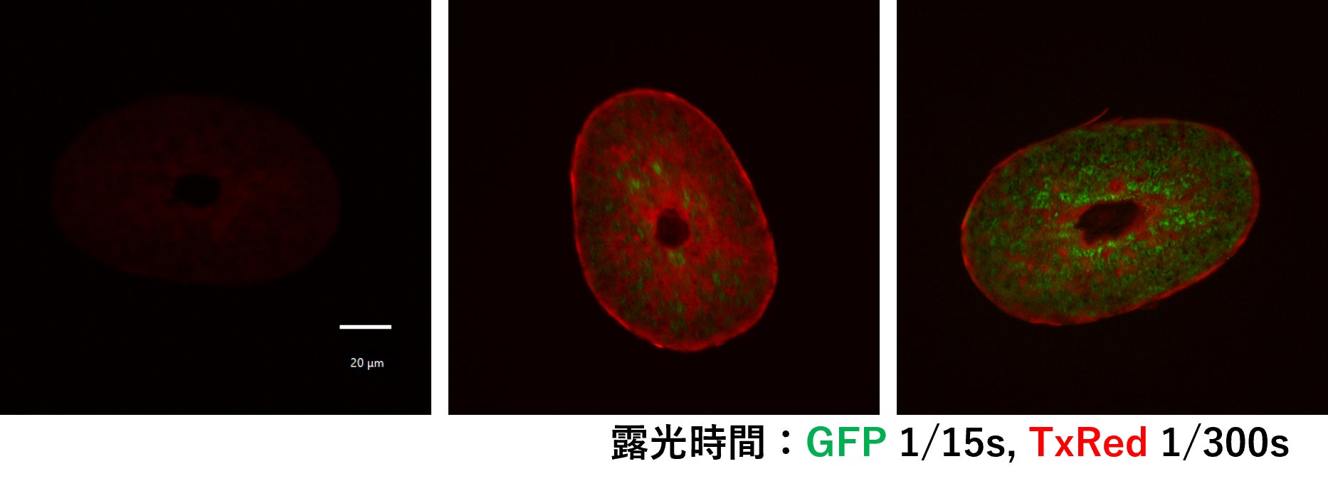販売実績２０万本を突破！ 角質ケア導入美容液「LIPOPEEL™ リポピール」 ～発売開始からわずか４ヶ月での驚異的なスピード達成～
