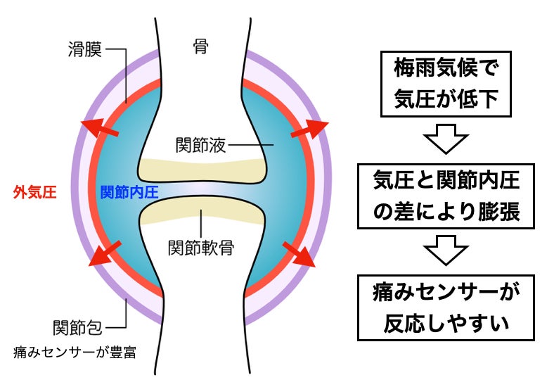 梅雨の「低気圧」が腰と膝を襲う湿気と気圧変化が引き起こす“梅雨時の不調”に整体でアプローチ