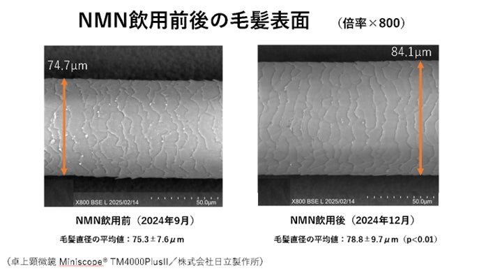 NMNの毛髪への影響に関する最新試験結果を発表