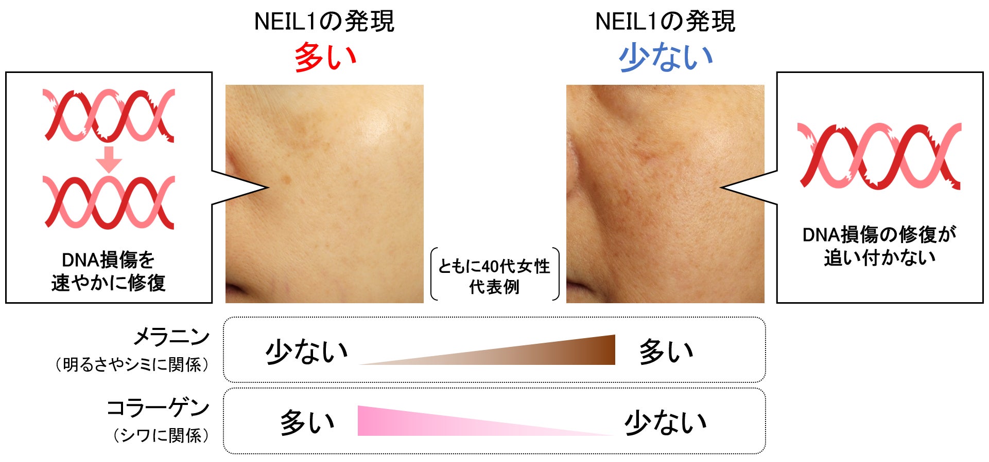 肌のメラニン、コラーゲンの量に影響を及ぼすDNA修復酵素を発見 ～美肌に重要なDNA修復酵素『NEIL1』～