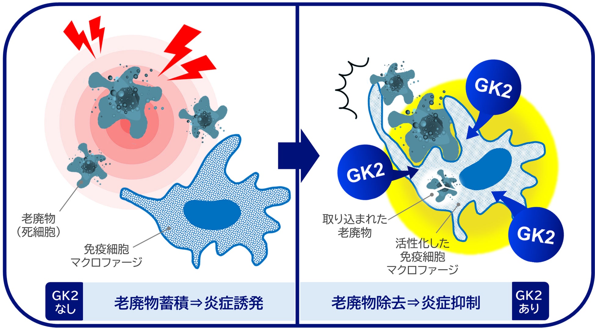 歯周病(※1)の発症・進行予防には歯ぐきの免疫機能が重要であることを確認～免疫機能に着目した歯周病予防の新たなアプローチ～