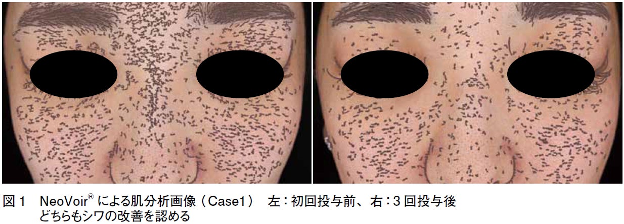TCB塩見涼菜医師らの”肌育”研究論文が日本先端医療医学会の学会誌に掲載。最新の肌分析機を用いて製剤別の特性を比較検討し、効果を可視化。