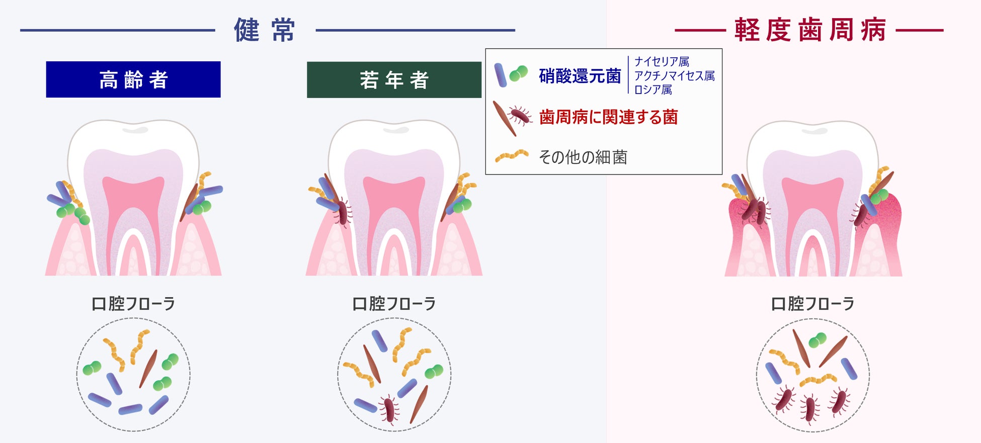 高齢でも健康な口腔を保ち続ける人は、硝酸還元菌の多い健康型の口腔フローラを保有していることを発見