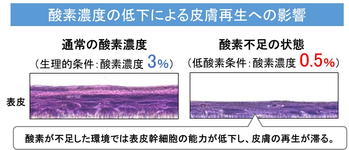 肌が薄くなるのは酸素不足？ ～皮膚の低酸素状態が幹細胞に与える影響を解明～