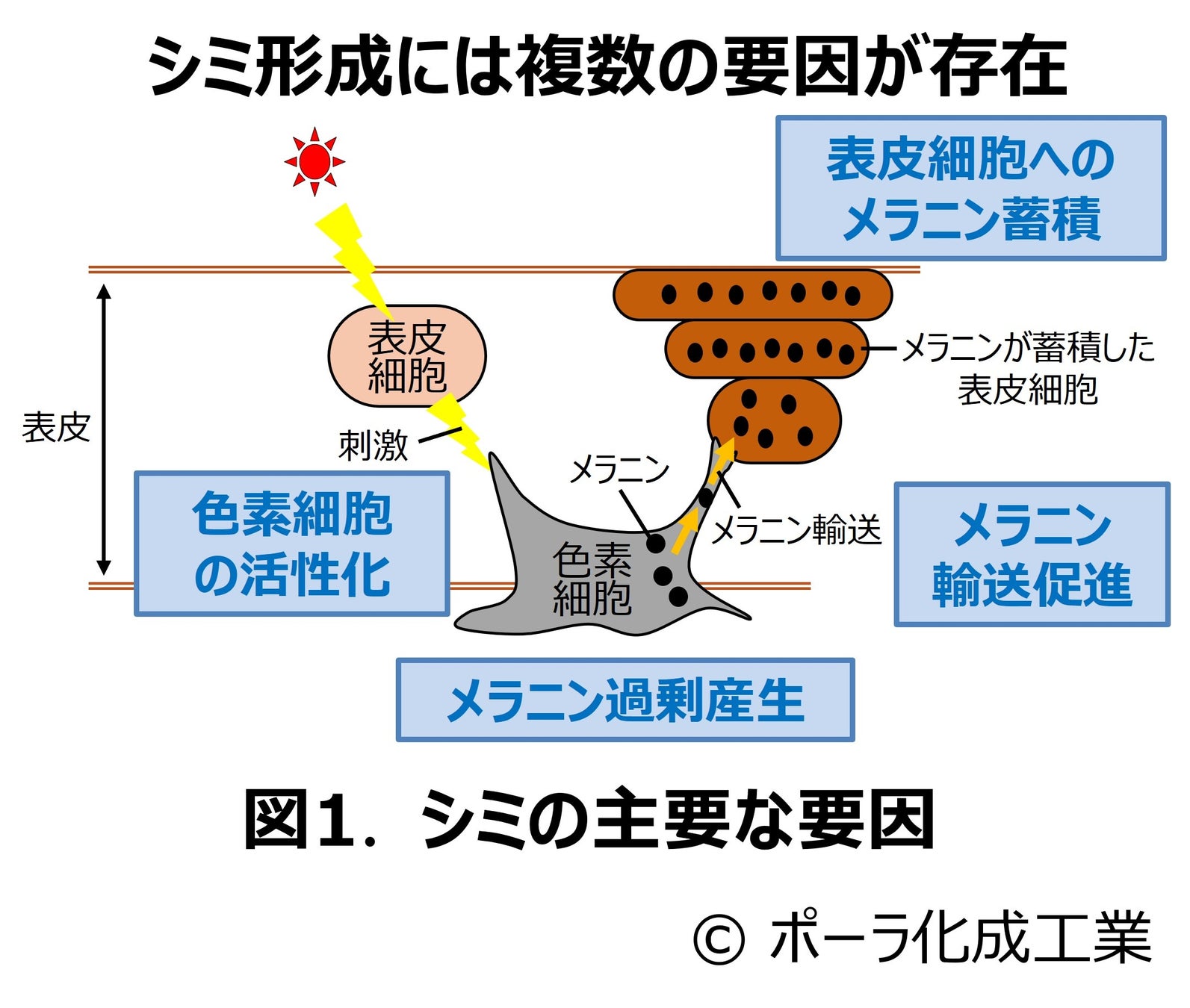 シミごとに形成要因は異なっていた