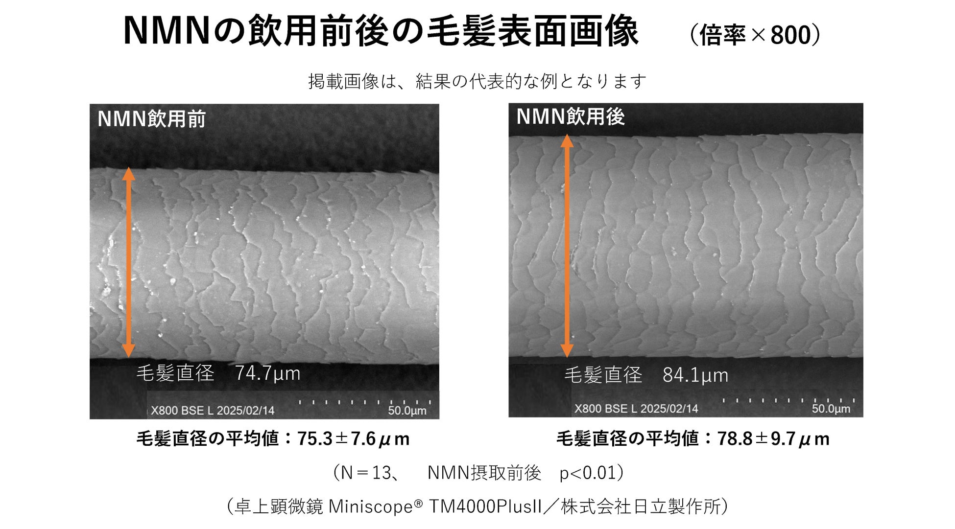 NMNの経口摂取が毛髪に及ぼす影響に関する臨床試験を実施