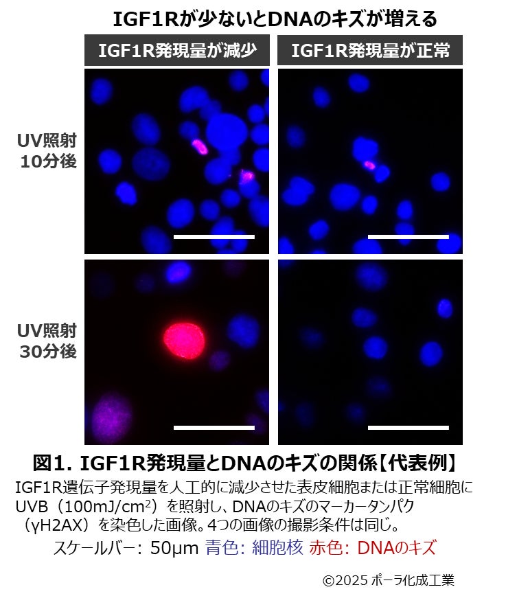 紫外線（UV）を浴びた直後のDNA修復がUVディフェンス力を決める