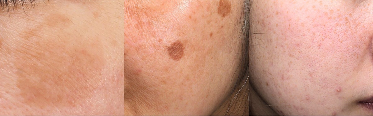 2025年版・年末の“駆け込み美容医療”ランキング調査【施術解説付】