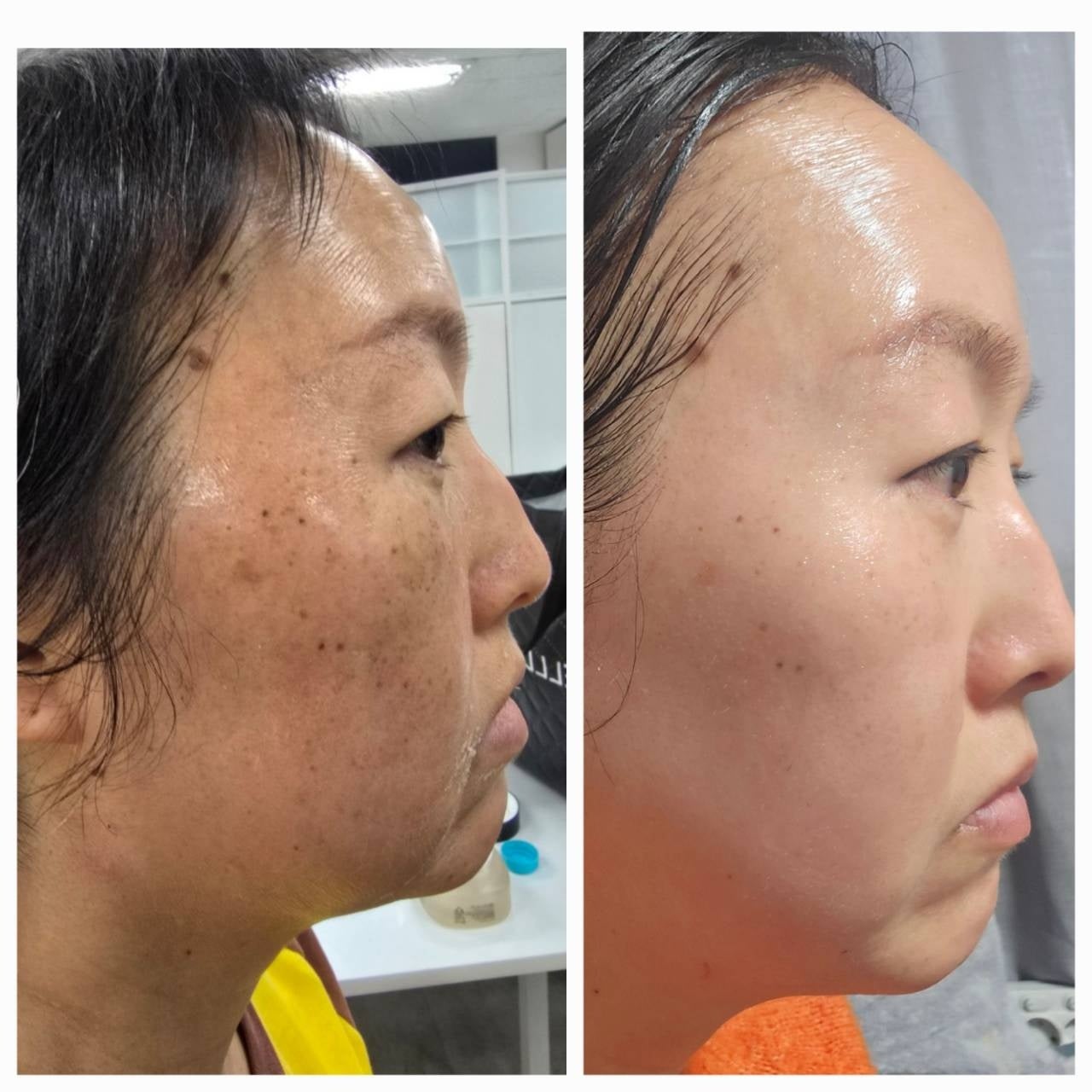 韓国発「インセルダム（INCELLDERM）」がついに日本上陸。株式会社GrandFusionが日本公式代理店としてサロン導入を本格展開