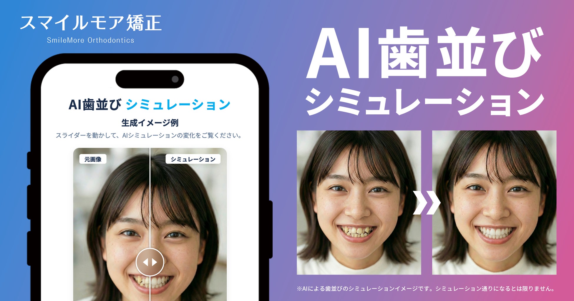スマイルモア矯正が歯科医監修の「AI歯並びシミュレーション」をリリース！