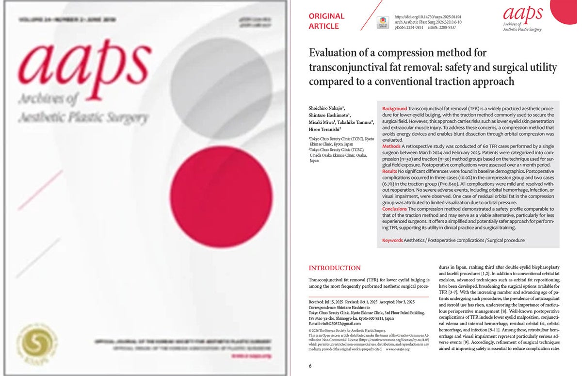 TCB中上勝一朗医師らの研究が国際学術誌「Archives of Aesthetic Plastic Surgery」に掲載。経結膜脱脂術における新アプローチ”圧迫法”の安全性と有用性を検証。