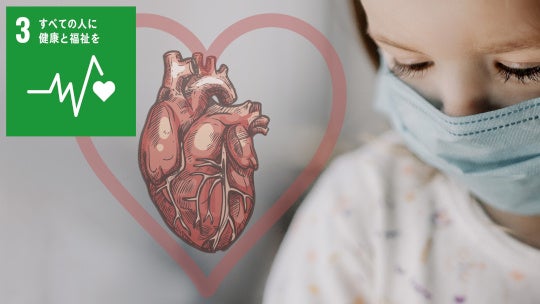 「マスク」が大気汚染による心筋梗塞のリスクを下げた？〜閉塞血管のない心筋梗塞リスクがコロナ禍で減少〜