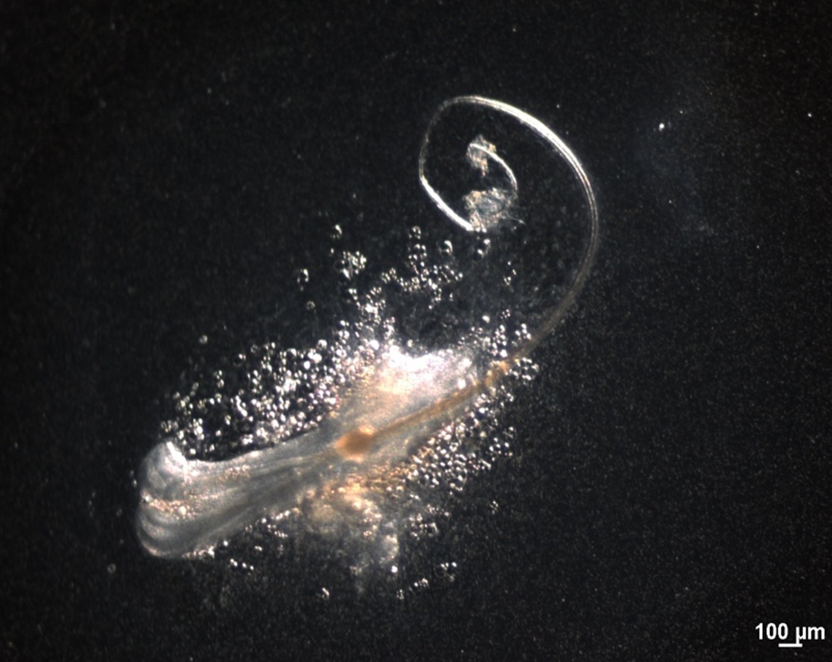 成体毛包の3種類の幹細胞により生体外で髪の毛を再生