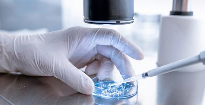 リジェネソーム、Good Hero Therapeutics、ユーグレナの3社で、エルゴチオネインを用いたウイルスベクター生産性増強技術の特許を出願