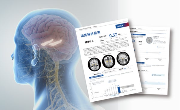 プルプルのジェリーなような透明感を楽しむコレクション “My Jelly Crush!”をイオン限定発売！