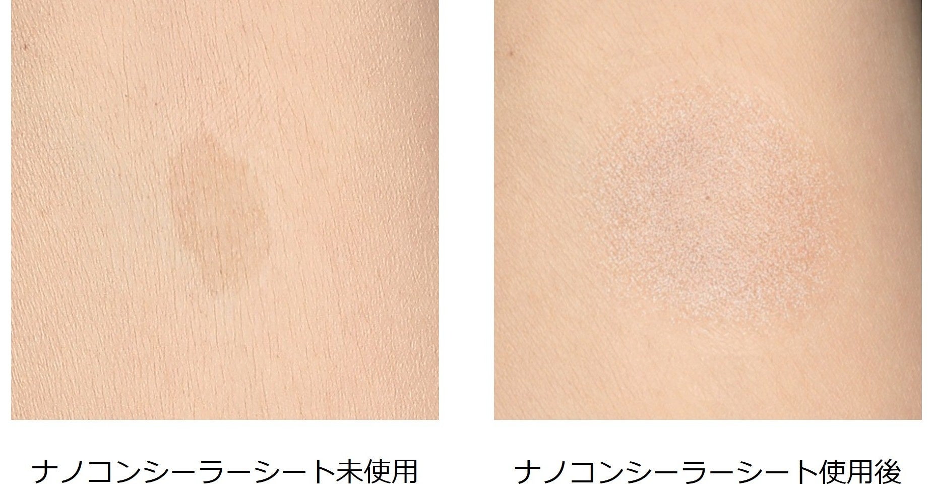 しみ・あざなどの深い肌悩みに寄り添う　ナチュラルハイカバーを叶える「ナノコンシーラーシート」を開発
