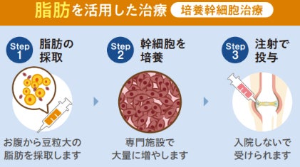【医療法人社団活寿会×神戸大学】ひざ再生医療の「効果の鍵」を特定｜共同研究論文が国際学術誌に掲載