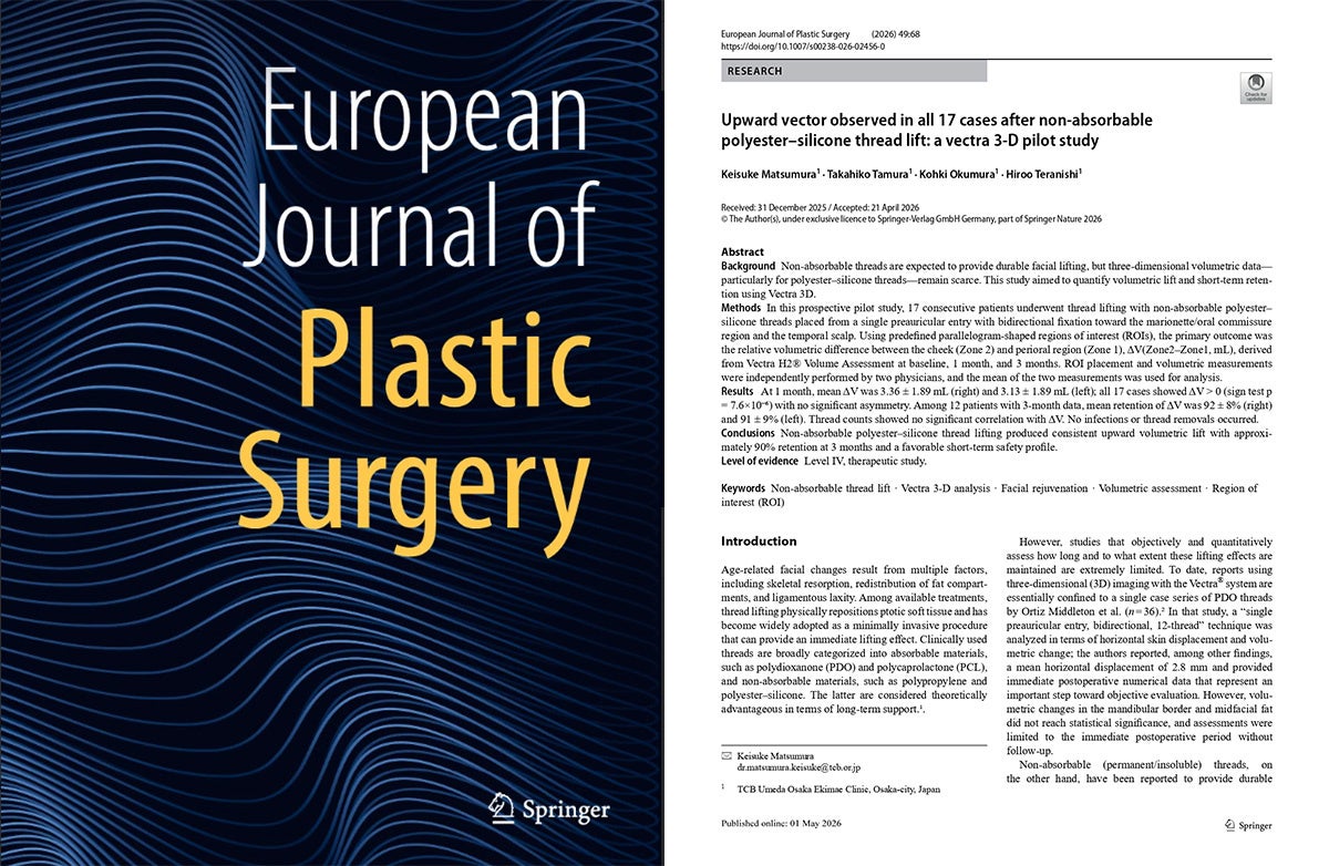TCB松村圭祐医師らの糸リフトに関する論文が国際学術誌「European Journal of Plastic Surgery」に掲載。三次元画像解析システムで効果と保持率を定量化。