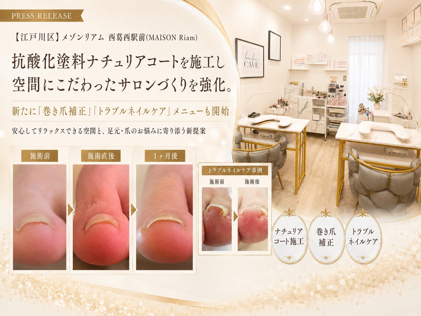 【シリーズ累計1億袋突破※】カロリミットシリーズ最高峰「プレミアムカロリミット」新CMに井川遥さん登場!
