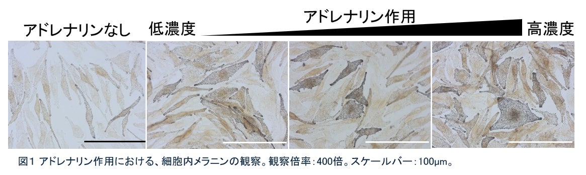 メラニン産生の新しい視点！～心理的ストレスがメラニンの産生を促進する可能性を報告～