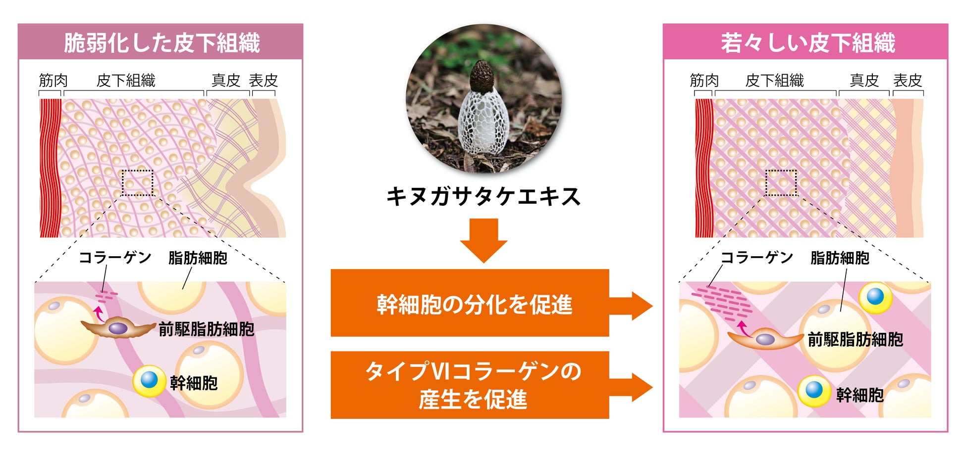 首・デコルテのタルミ要因にアプローチするエキスを開発　皮下組織の幹細胞の分化を促し、コラーゲン産生を高めるキヌガサタケエキス