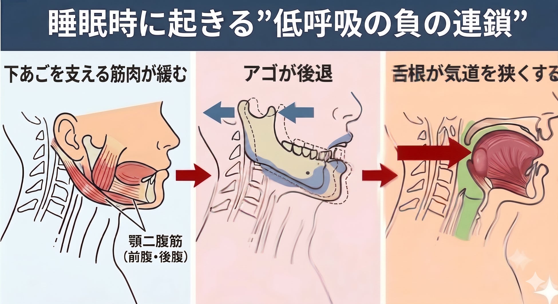 睡眠中の呼吸構造が示す新事実 ──CPAP離脱者に共通する“隠れ低呼吸”と体内環境の落差（シリーズ第一回）