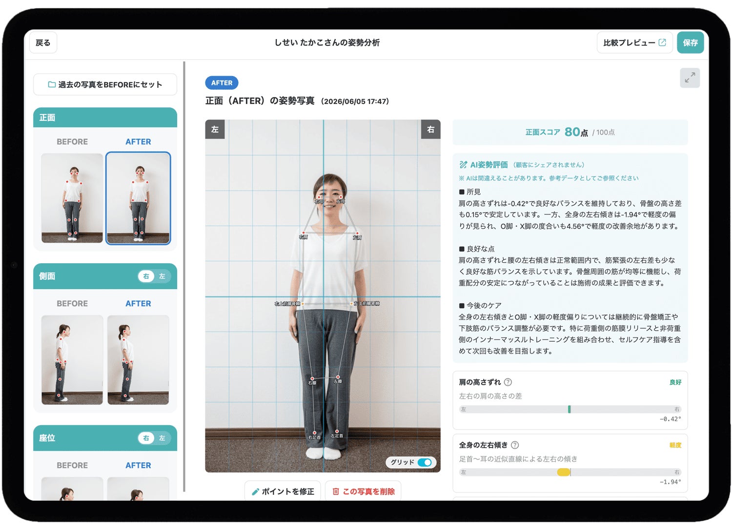 【現場と共創した「AI姿勢分析」】整骨院・鍼灸院向け電子カルテ『カルッテ』が、施術の価値を”見える化”する新機能を提供開始