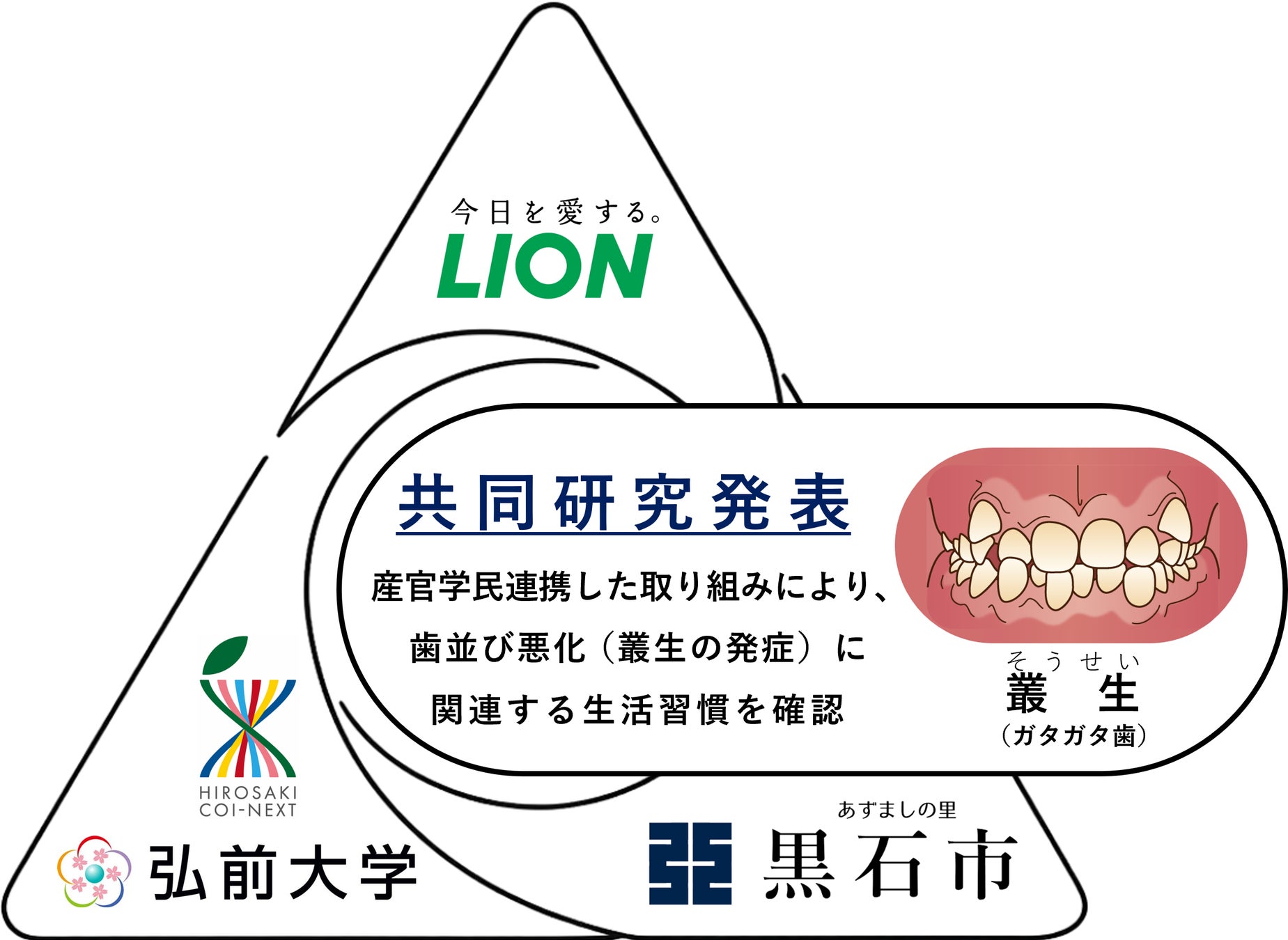 ライオン、弘前大学と青森県黒石市と共同で、「睡眠時の口呼吸」や「あまり噛まない」習慣が、歯並び悪化に関与する可能性を確認