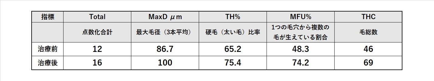 東京ミッドタウン皮膚科形成外科Noage上島朋子医師の男性型脱毛症（MAGA)研究が、美容皮膚・ヒト臨床ジャーナル「Journal of Cosmetic Dermatology」に掲載