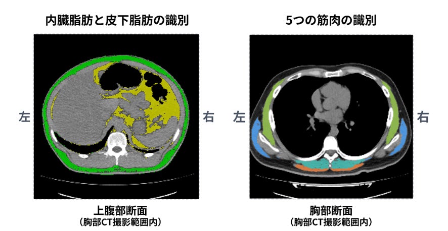 スマートドック、「からだ健康度AI解析」の提供を開始
